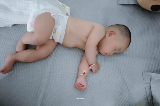 巢湖六个月宝宝眼睛散光